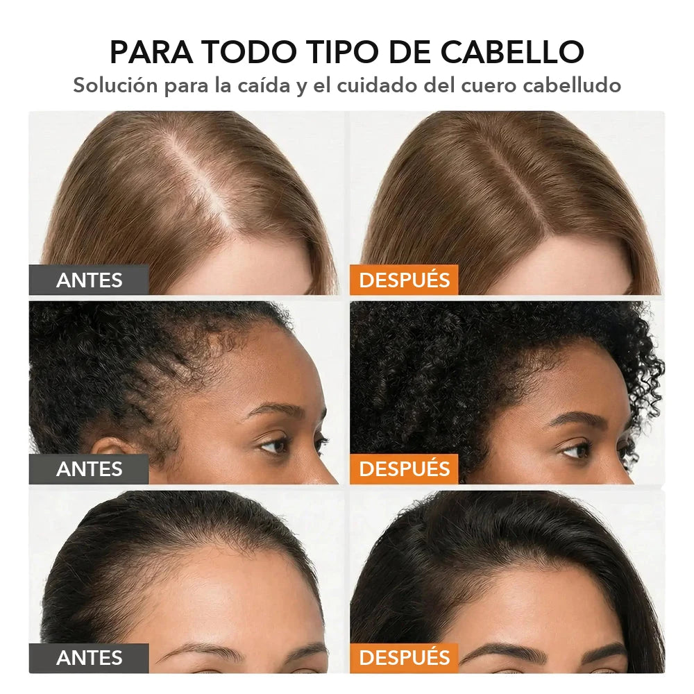 Sérum Avera para el crecimiento del cabello